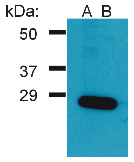 IHC-plus™ Polyclonal Rabbit anti-Human GRB2 Antibody (clone Polyclonal, C-Terminus, IHC, WB)