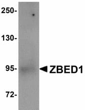 ZBED1 / TRAMP Antibody