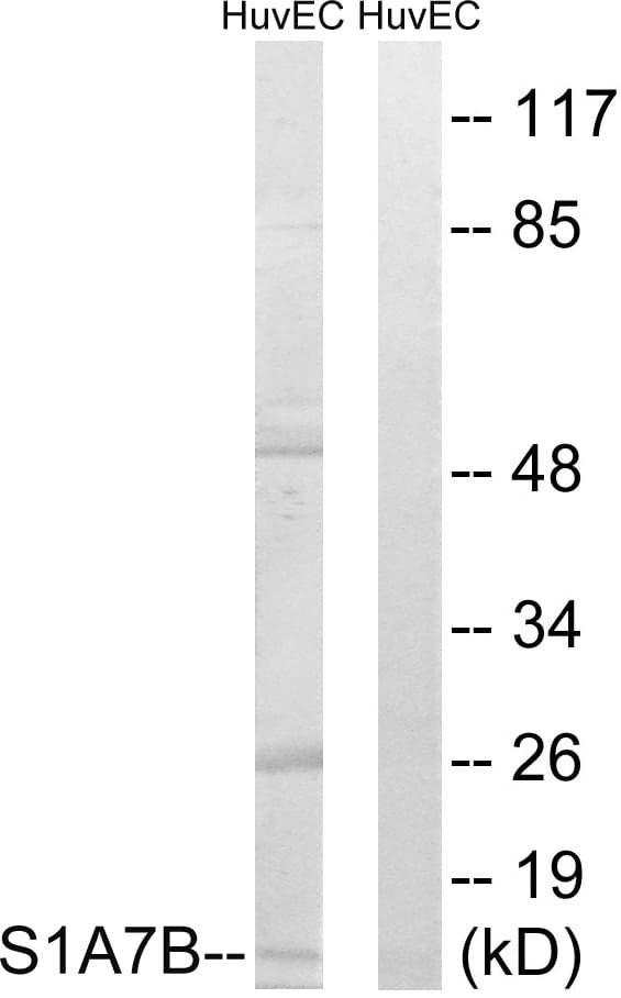 S100A7L2 Antibody (aa38-87)