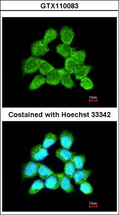 LARS2 / LEURS1 Antibody (aa181-458)