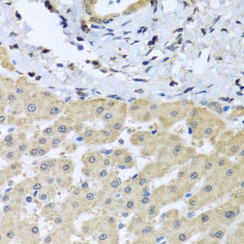 LETMD1 / HCCR1 Antibody