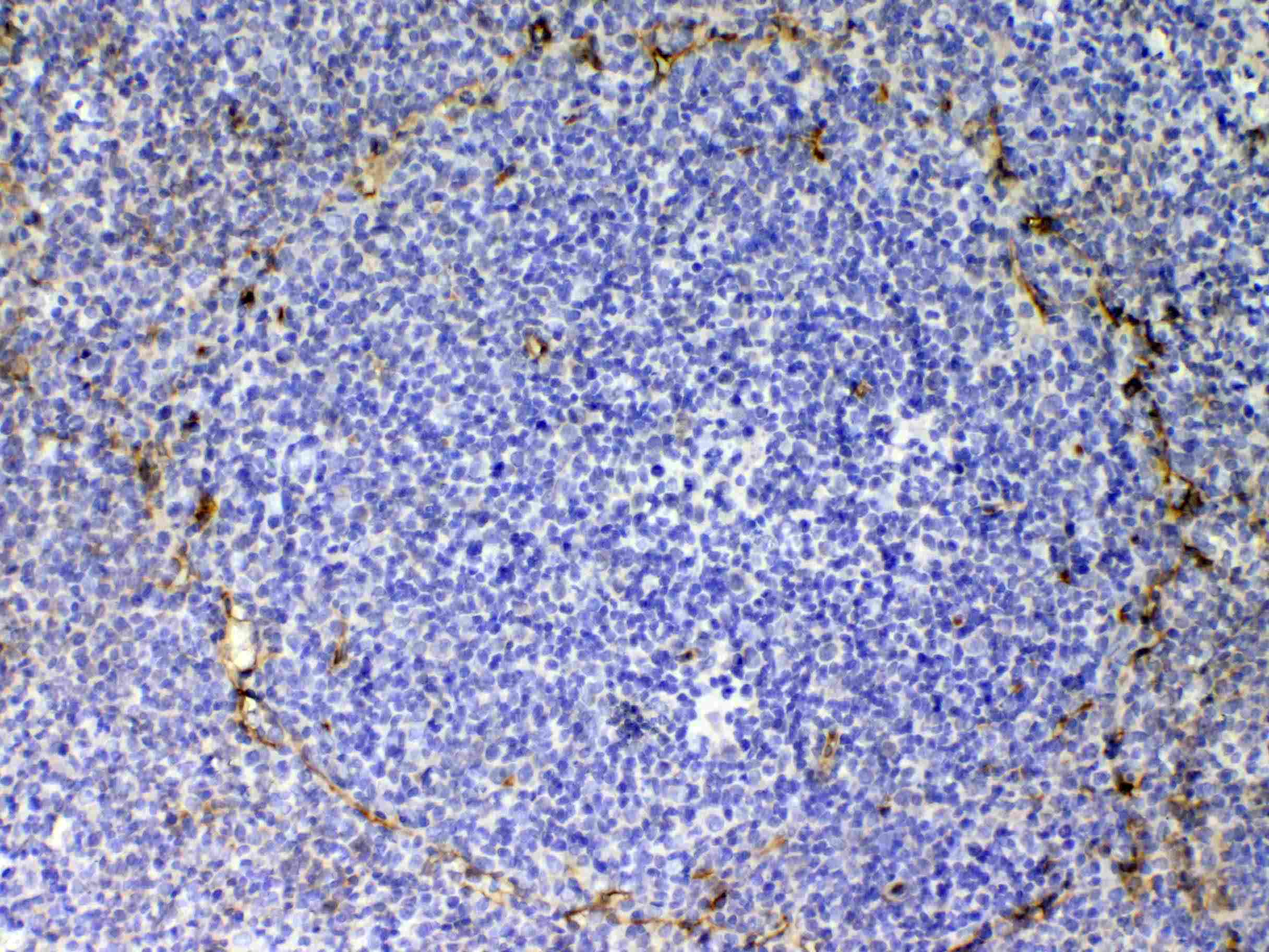 CD105 Antibody