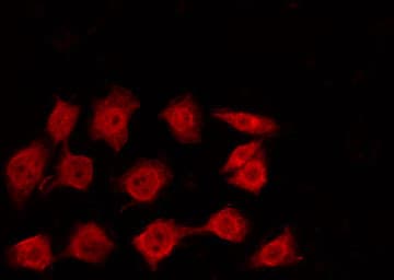 CBX3 / HP1 Gamma Antibody