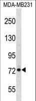 BLAP75 / RMI1 Antibody (aa105-133)