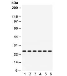 Polyclonal Rabbit anti-Human RAB5A / RAB5 Antibody (IHC, WB)