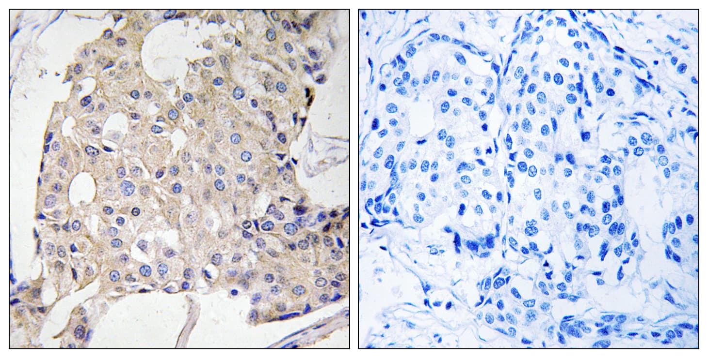 Polyclonal Rabbit anti-Human NDRG3 Antibody (aa206-255, IHC, WB)