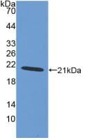 AIF1 / IBA1 Antibody (aa1-147)