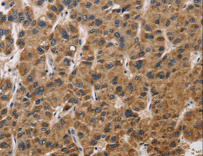 IHC-plus™ IL19 Antibody (aa39-52)
