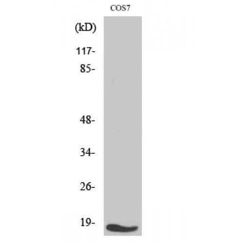 TGFA / TGF Alpha Antibody (80-160 aa, C-terminal)
