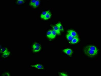SLC45A3 / Prostein / p501S Antibody