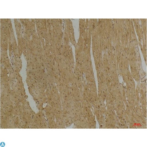 DES / Desmin Antibody