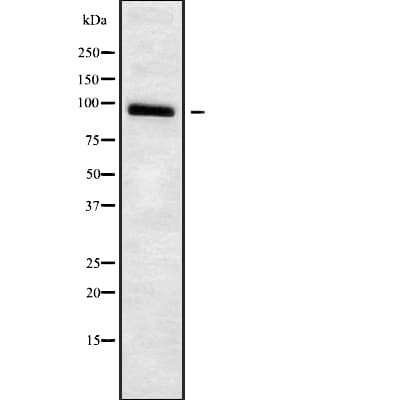 Polyclonal Rabbit anti-Human ADAM23 Antibody (WB)