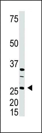Polyclonal Rabbit anti-Human DKK4 Antibody (aa188-217, IHC, WB)