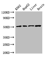 Polyclonal Rabbit anti-Human TIP48 / RUVBL2 Antibody (IHC, WB)