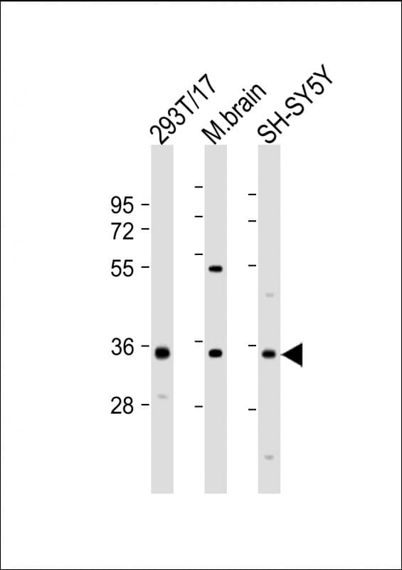 Polyclonal Rabbit anti-Human NAT8L Antibody (aa59-93, WB)
