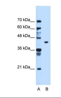 PGK1 / Phosphoglycerate Kinase Antibody (aa301-350, Biotin)