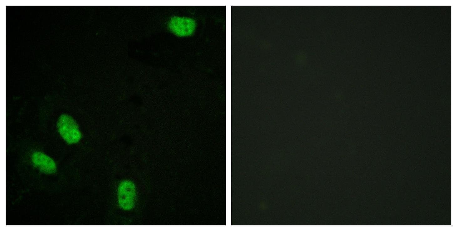 PR / Progesterone Receptor Antibody (phospho-Ser294)