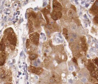 MAP3K3 / MEKK3 Antibody