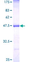 Human MTAP Protein (Recombinant GST)