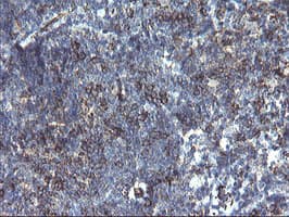 PECAM-1 / CD31 Antibody (clone OTI2B5)