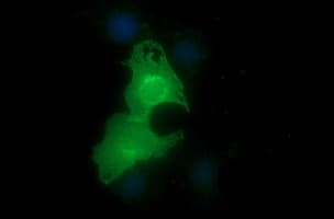 EPCAM Antibody (clone OTI2B6)