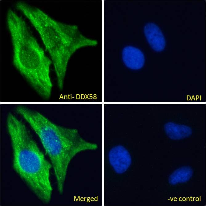 IHC-plus™ DDX58 / RIG-1 / RIG-I Antibody (C-Terminus)