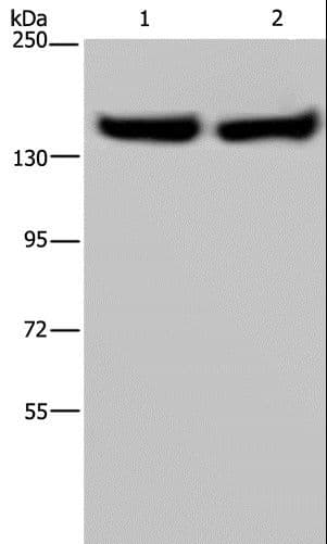 ITGA2B / CD41 Antibody
