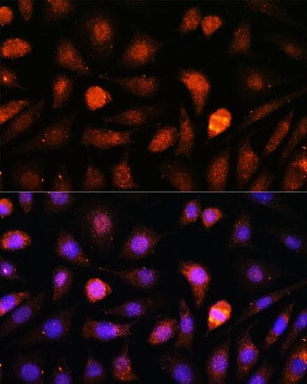 HSPC167 / CDK5RAP1 Antibody
