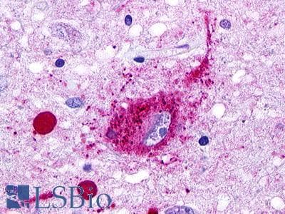 PathPlus™ Polyclonal Rabbit anti-Human GPR49 / LGR5 Antibody (Cytoplasmic Domain, IHC)
