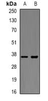 Polyclonal Rabbit anti-Human XBP1 Antibody (WB)