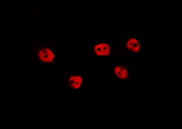 Polyclonal Rabbit anti-Human HIF2A / EPAS1 Antibody (IF, WB)