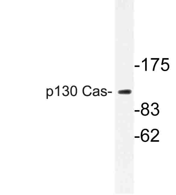 Polyclonal Rabbit anti-Human BCAR1 / p130Cas Antibody (Val404, IHC, WB)