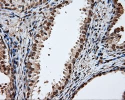 DAPK2 / DAP Kinase 2 Antibody (clone OTI1C5, Carrier-free)