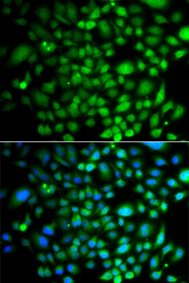 PTK6 / BRK Antibody