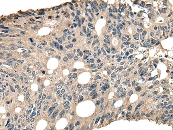 SLAMF7 / CRACC Antibody