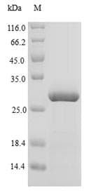 Cow ASIP Protein (Recombinant 6His-SUMO, N-terminus)