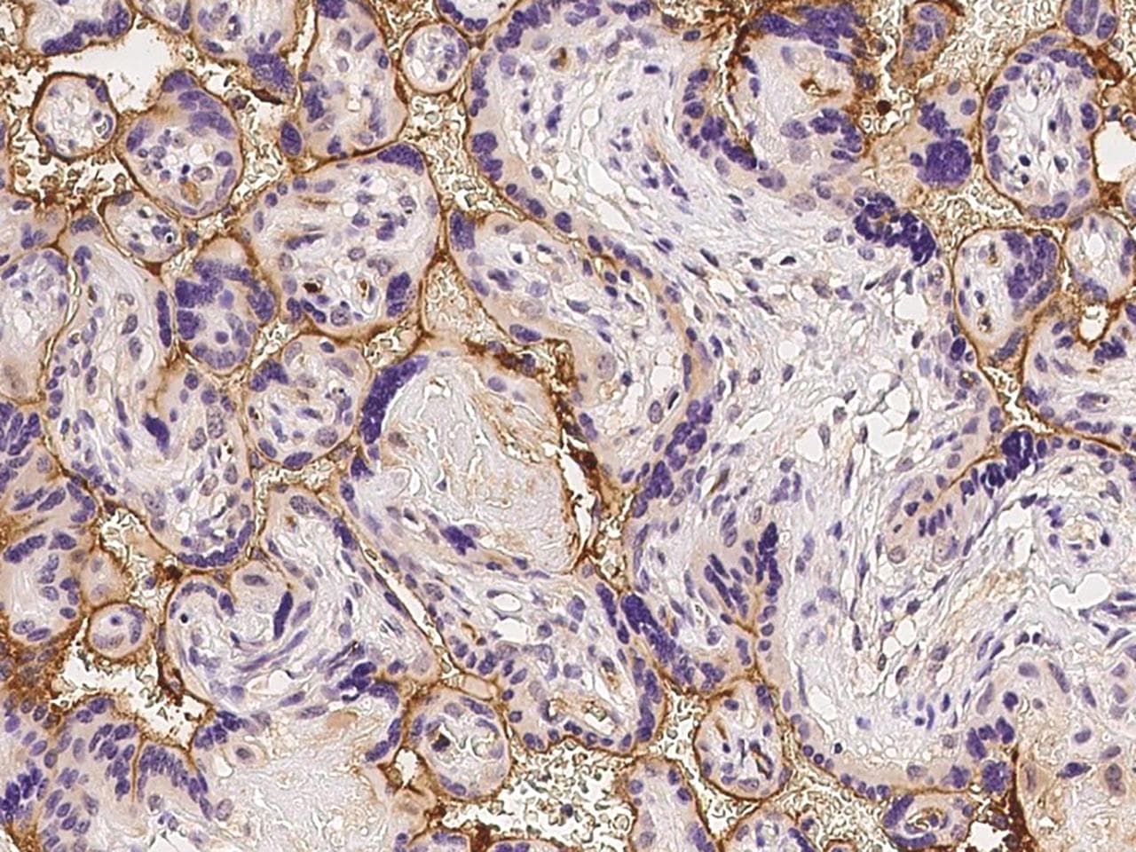 HSPA5 / GRP78 / BiP Antibody