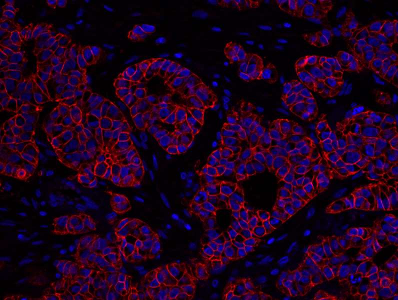 Polyclonal Rabbit anti-Human ERBB2 / HER2 Antibody (aa1200-C-term, IHC, IF)