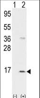 CXCL7 / PPBP Antibody (aa23-54)