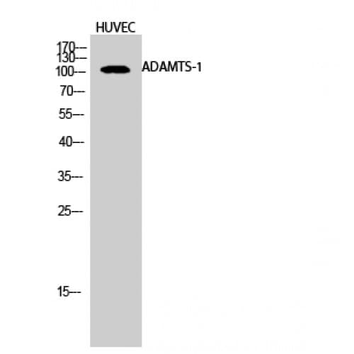 Polyclonal Rabbit anti-Human ADAMTS1 Antibody (160-240 aa, Internal, WB)