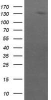 ERBB2 / HER2 Antibody (aa676-1255, clone OTI1A12, Carrier-free)