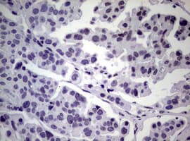 NBN / Nibrin Antibody (clone OTI6E11)