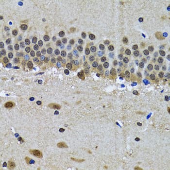 SPIN / SPIN1 Antibody