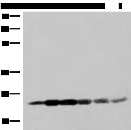GSTK1 Antibody