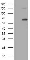 PKLR Antibody (clone OTI1H4)