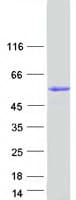 Human GK5 Protein (Recombinant Myc-DDK (Flag))