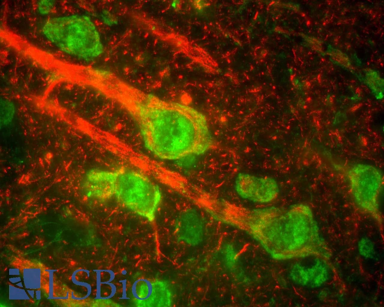 NEFM / NF-M Antibody