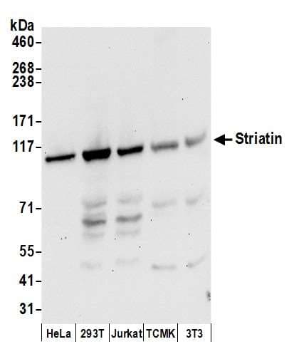 Polyclonal Rabbit anti-Human STRN / Striatin Antibody (aa250-300, WB)
