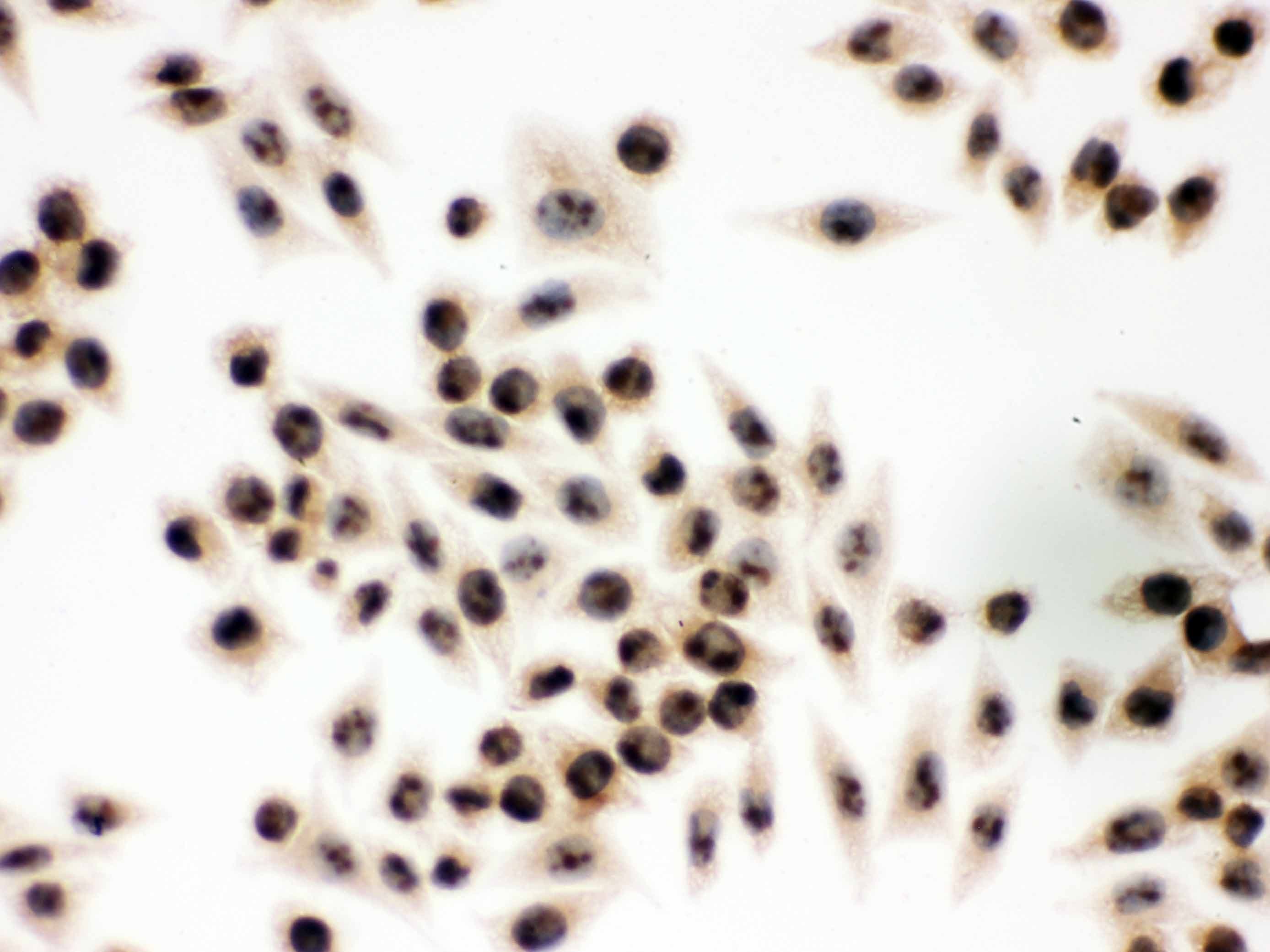 Polyclonal Rabbit anti-Human EIF6 Antibody (aa66-210, IHC, WB)