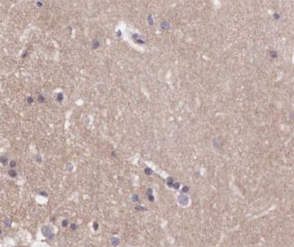 GRM4 / MGLUR4 Antibody